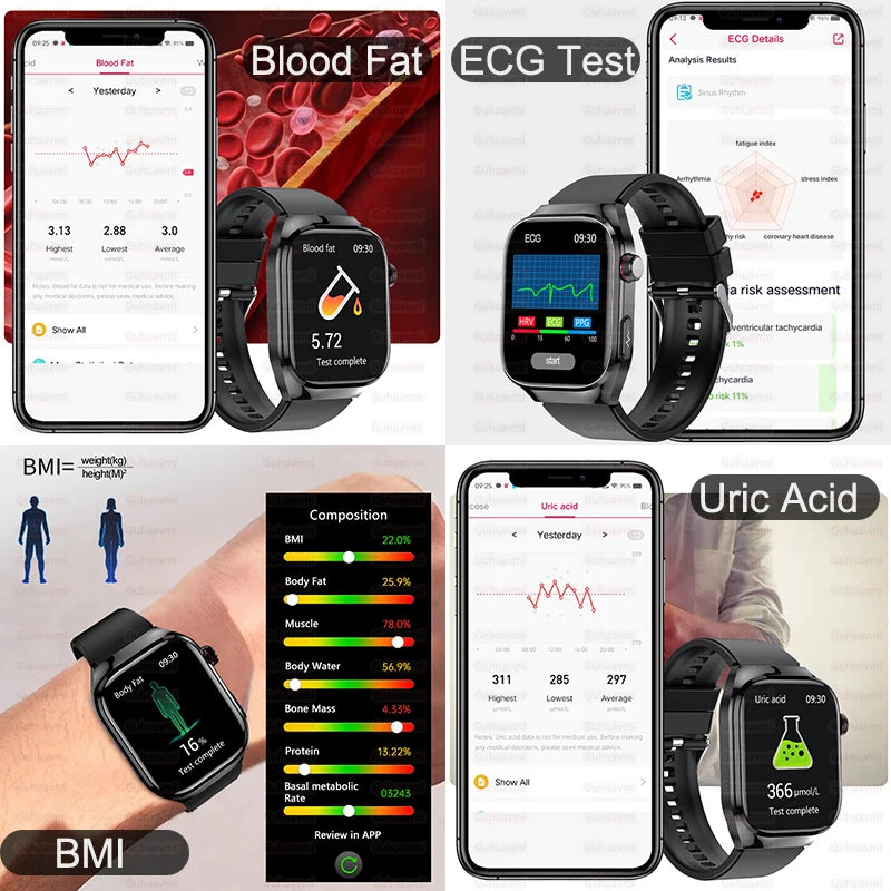 2025 Smart Health Watch – Uric Acid & Body Fat Monitor